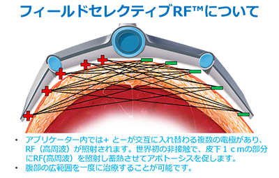 痩身マシン vanquish フィールド