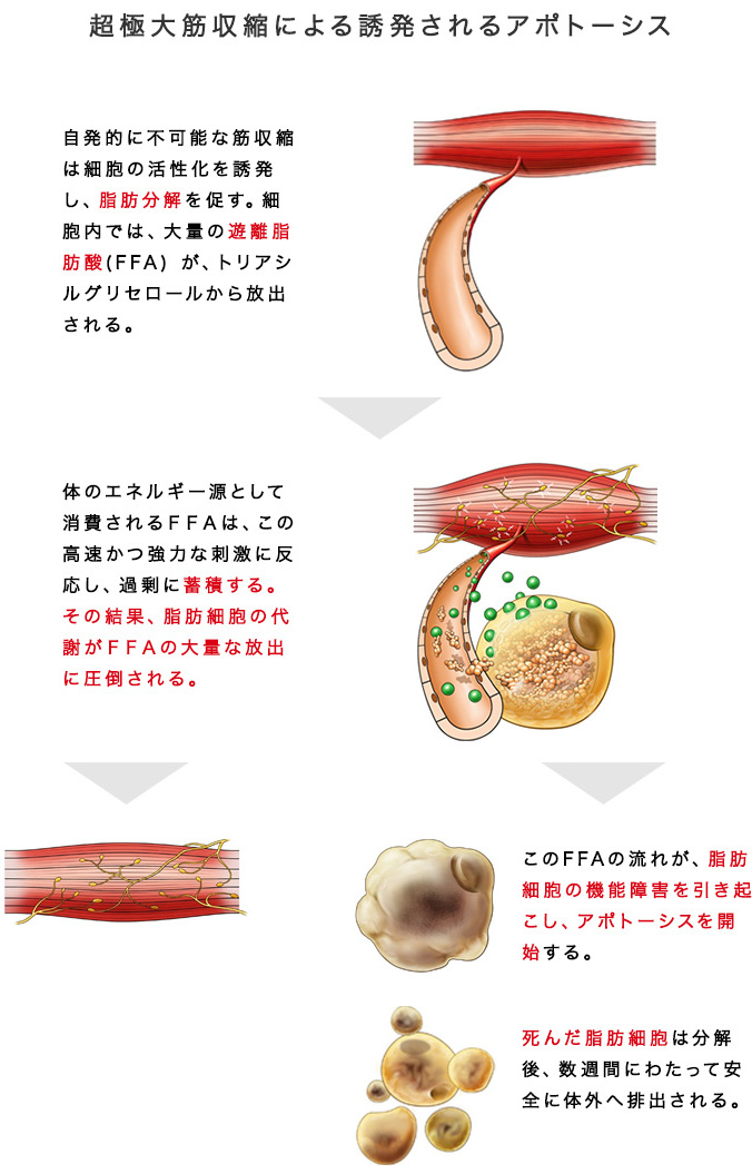 超極大筋収縮による誘発されるアポトーシス