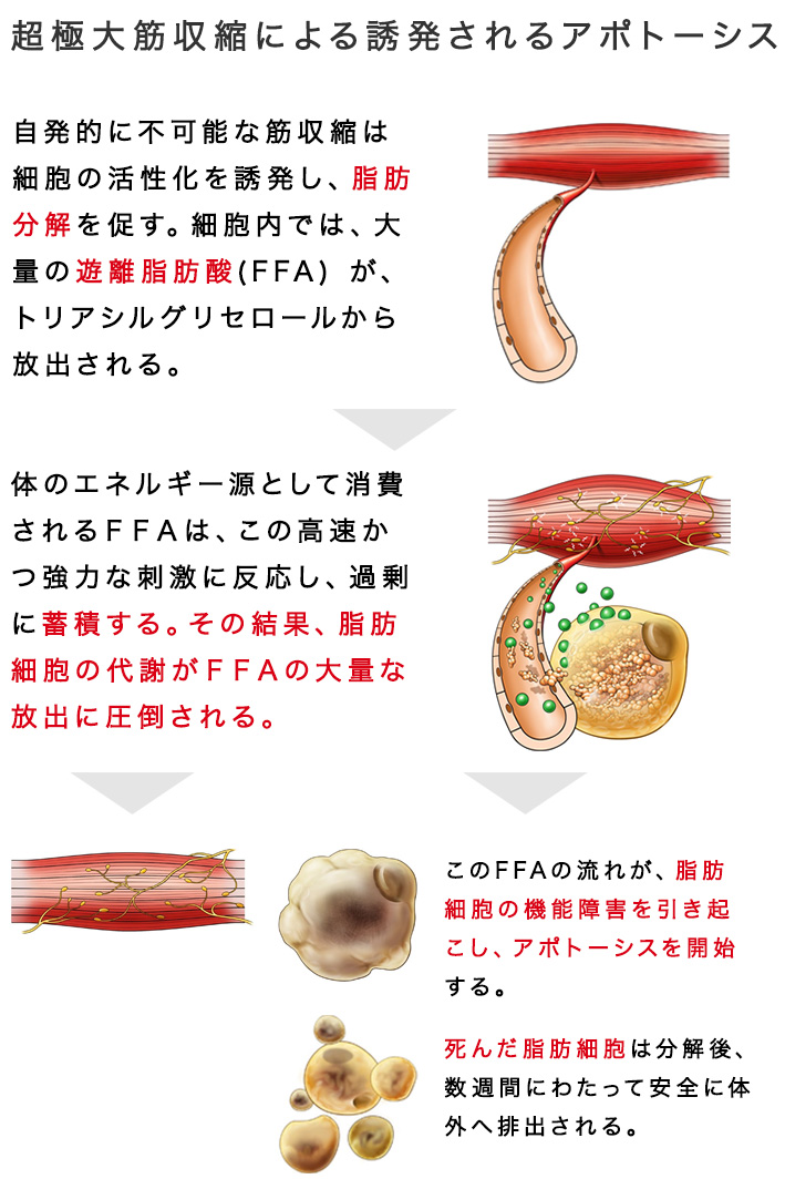 超極大筋収縮による誘発されるアポトーシス